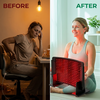 HelioCurve Elite Red/NIR Therapy Panel — Before & After